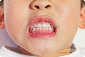 mft_image04